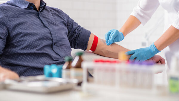 Close up of nurse disinfecting male arm before blood test. Man is sitting on chair near medical set