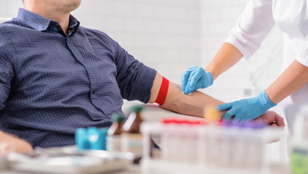 Close up of nurse disinfecting male arm before blood test. Man is sitting on chair near medical set